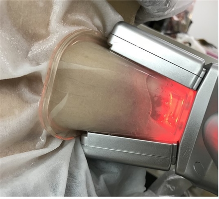 Διπλή καναλιών τύπων μηχανή παγώματος Cryolipolysis παχιά για Cellulite Redction
