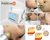 Φορητή κλασματική μηχανή RF Microneedle για τη μείωση ρυτίδων λαιμών