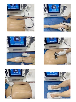 3 σε 1 Diathermy EMS Tecar Shockwave μηχανή για τη φυσιοθεραπεία σώματος για τον αθλητικό τραυματισμό και την επίδραση Cellulite